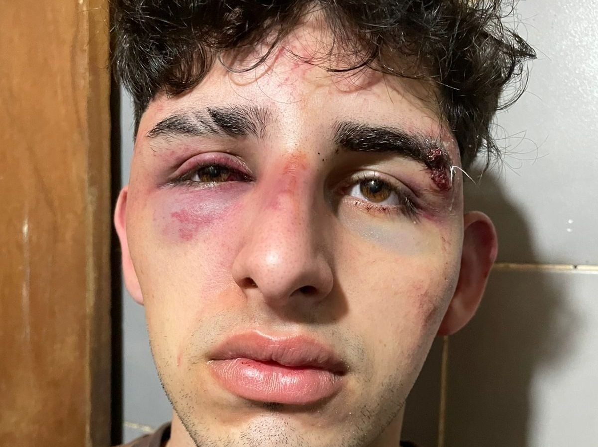 Imputan a guardia de un boliche por agredir a un joven