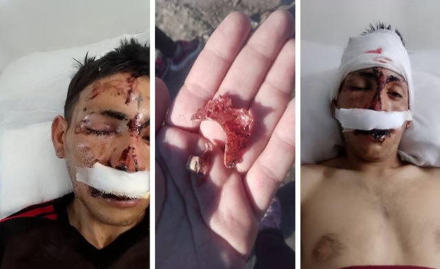 Dos hermanos golpearon a un joven hasta desfigurarlo