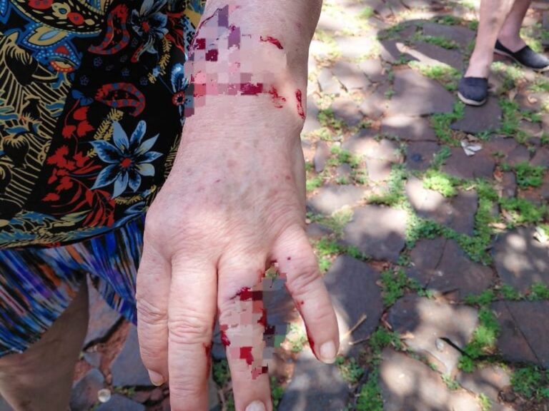 Dos mujeres fueron hospitalizadas tras ser atacadas por pitbulls