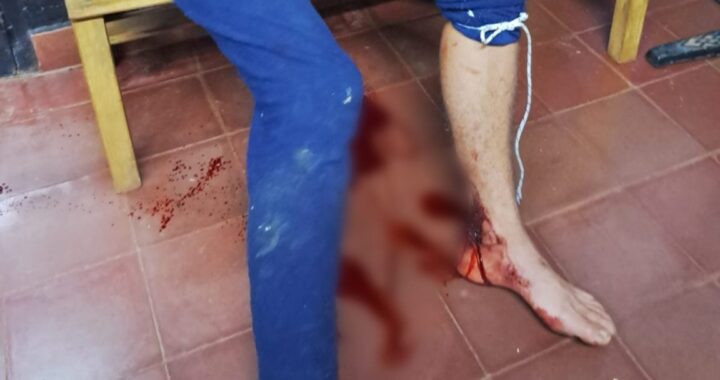 ladrón quedó atrapado en el alambre cuando intentaba ingresar a una vivienda