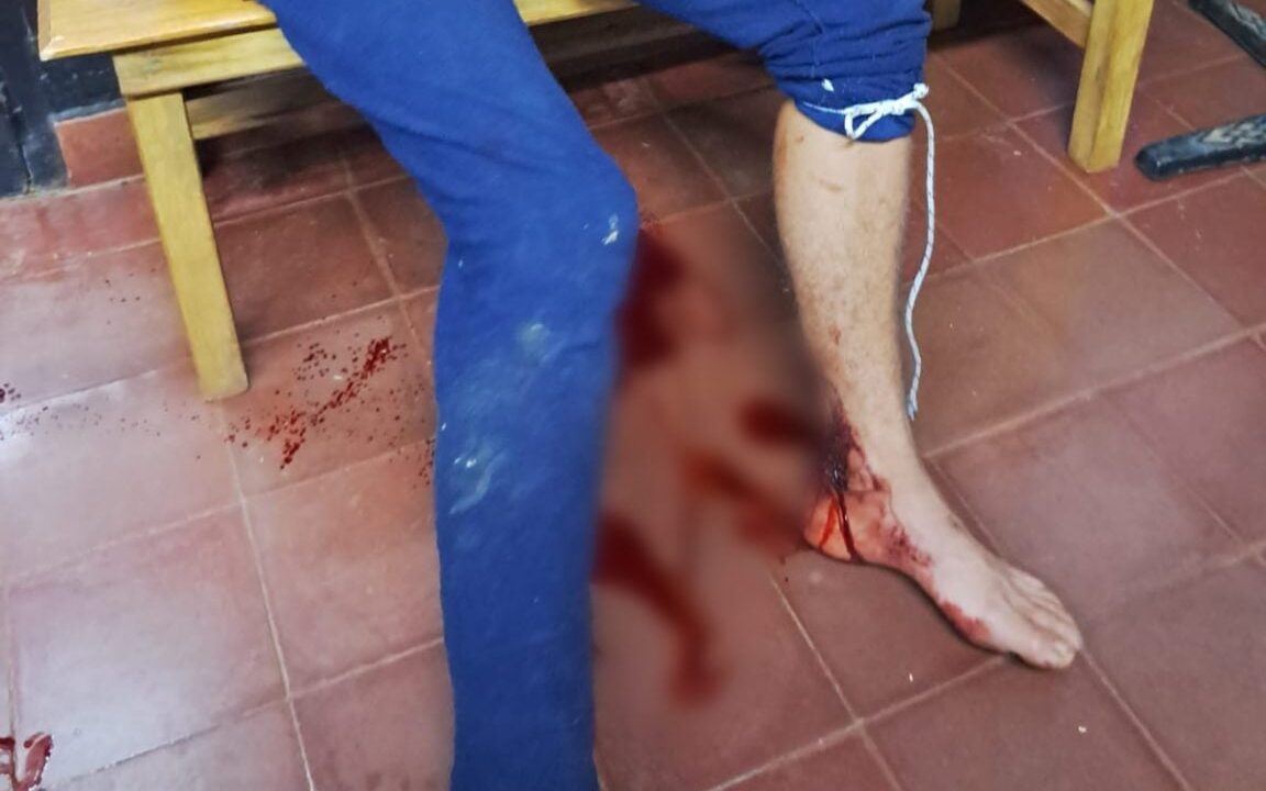 ladrón quedó atrapado en el alambre cuando intentaba ingresar a una vivienda