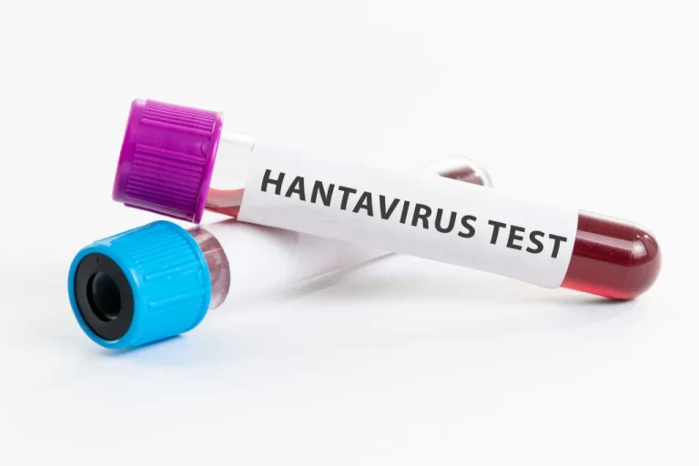 Confirman casos de hantavirus en Brasil y crece la preocupación en la frontera con Misiones